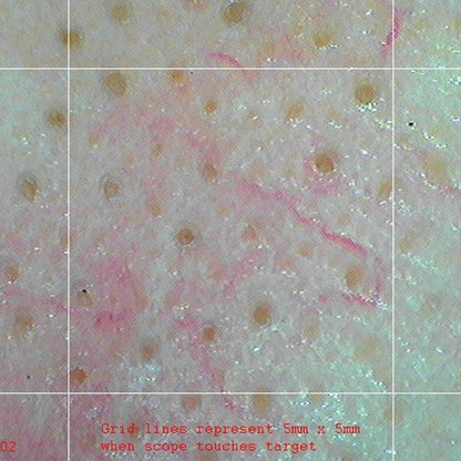 Firefly DE370 HD Mobile Wireless Polarizing Dermatoscope Medvana UK