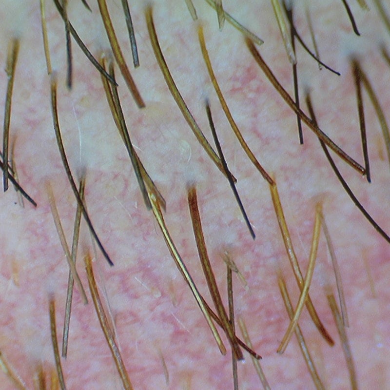 Firefly DE370 HD Mobile Wireless Polarizing Dermatoscope Medvana UK