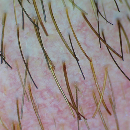 Firefly DE370 HD Mobile Wireless Polarizing Dermatoscope Medvana UK